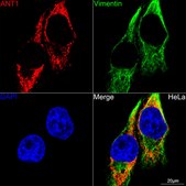 Anti-CaMKII Antibody, clone 7L9F0, Rabbit Monoclonal