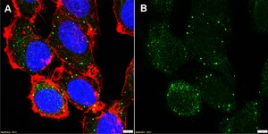 Anti-Collagen α-4 Antibody, clone 1F3 ZooMAb® Rabbit Monoclonal recombinant, expressed in HEK 293 cells