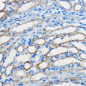 Anti-ATF6 antibody produced in rabbit