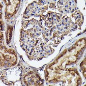 Anti-Human IgM Antibody, clone 6F7T2, Rabbit Monoclonal