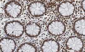 Anti-HMGA1 Antibody, clone 1F20 ZooMAb® Rabbit Monoclonal recombinant, expressed in HEK 293 cells