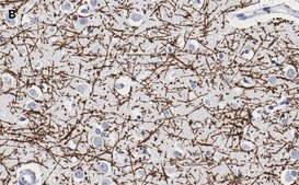 Anti-MBP Antibody, clone 2N6 , ZooMAb® Rabbit Monoclonal recombinant, expressed in HEK 293 cells