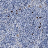 Anti-ALOX15 antibody produced in rabbit Prestige Antibodies® Powered by Atlas Antibodies, affinity isolated antibody, buffered aqueous glycerol solution
