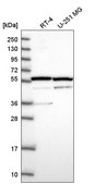 Anti-MDM4 antibody produced in rabbit Prestige Antibodies® Powered by Atlas Antibodies, affinity isolated antibody
