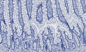 Anti-Calpain-1 Antibody, clone 1H14 ZooMAb® Rabbit Monoclonal recombinant, expressed in HEK 293 cells