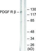 Anti-PDGFR β antibody produced in rabbit affinity isolated antibody