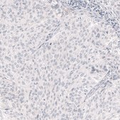 Monoclonal Anti-NANOG antibody produced in mouse Prestige Antibodies® Powered by Atlas Antibodies, clone CL5803, purified immunoglobulin, buffered aqueous glycerol solution