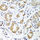 Anti-OXCT1 antibody produced in rabbit
