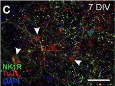 Anti-Substance P Receptor antibody produced in rabbit IgG fraction of antiserum, buffered aqueous solution