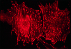 抗 Talin 单克隆抗体 小鼠抗 clone 8d4, ascites fluid