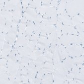 Anti-RYR2 antibody produced in rabbit Prestige Antibodies® Powered by Atlas Antibodies, affinity isolated antibody, buffered aqueous glycerol solution