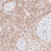 Monoclonal Anti-TH antibody produced in mouse Prestige Antibodies® Powered by Atlas Antibodies, clone CL3049, purified immunoglobulin, buffered aqueous glycerol solution