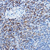 Anti- Bax antibody produced in rabbit