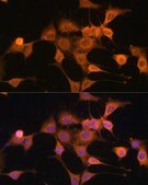 Anti-BAX antibody produced in rabbit
