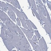 Anti-CCL2 antibody produced in rabbit Prestige Antibodies® Powered by Atlas Antibodies, affinity isolated antibody, buffered aqueous glycerol solution