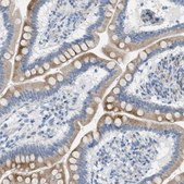 Anti-TEX264 antibody produced in rabbit Prestige Antibodies® Powered by Atlas Antibodies, affinity isolated antibody, buffered aqueous glycerol solution