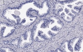 Anti-ATF3 Antibody, clone 1G12 ZooMAb® Rabbit Monoclonal recombinant, expressed in HEK 293 cells