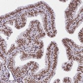 Anti-CREBBP antibody produced in rabbit Prestige Antibodies® Powered by Atlas Antibodies, affinity isolated antibody, buffered aqueous glycerol solution