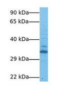 Anti-TPM1 IgG fraction of antiserum