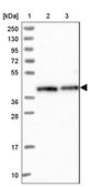 Anti-RBM4 antibody produced in rabbit Prestige Antibodies® Powered by Atlas Antibodies, affinity isolated antibody, buffered aqueous glycerol solution