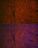 Anti-FABP3 Antibody, clone 9B9D7, Rabbit Monoclonal