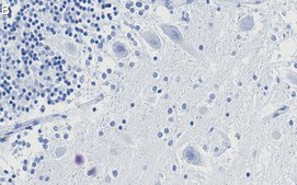 Anti-p27 Kip1 Antibody, clone 1B10 ZooMAb® Rabbit Monoclonal recombinant, expressed in HEK 293 cells