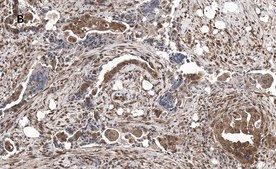 Anti-phospho JNK (Thr183, Tyr185) Antibody, clone 3F7, ZooMAb® Rabbit Monoclonal recombinant, expressed in HEK 293 cells