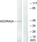 Anti-ADORA2A antibody produced in rabbit affinity isolated antibody