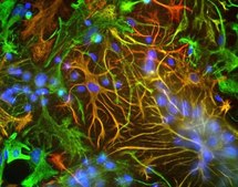 Anti-Vimentin Antibody serum, Chemicon®