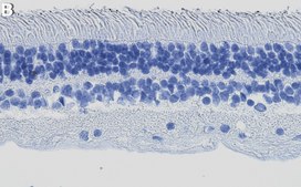 Anti-Arrestin-C Antibody, clone 1I3 ZooMAb® Rabbit Monoclonal recombinant, expressed in HEK 293 cells