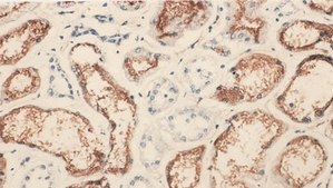 Anti-Angiotensin Converting Enzyme Antibody, clone 9B9 clone 9B9, Chemicon®, from mouse