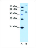 Anti-PPAT antibody produced in rabbit affinity isolated antibody
