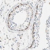 Anti-ATF6 antibody produced in rabbit Prestige Antibodies® Powered by Atlas Antibodies, affinity isolated antibody, buffered aqueous glycerol solution