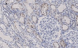 Anti-c-Myc Antibody, clone 7E18, ZooMAb® Rabbit Monoclonal recombinant, expressed in HEK 293 cells