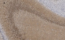 Anti-GluR2 Antibody, clone 1K4, ZooMAb® Rabbit Monoclonal recombinant, expressed in HEK 293 cells