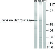 Anti-Tyrosine Hydroxylase, N-Terminal antibody produced in rabbit affinity isolated antibody