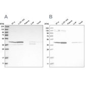 Anti-CNP antibody produced in rabbit Prestige Antibodies® Powered by Atlas Antibodies, affinity isolated antibody, buffered aqueous glycerol solution, Ab2