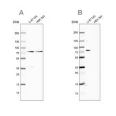 Anti-OPTN antibody produced in rabbit Ab2, Prestige Antibodies® Powered by Atlas Antibodies, affinity isolated antibody, buffered aqueous glycerol solution