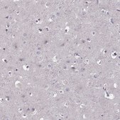抗-CD28 兔抗 Prestige Antibodies® Powered by Atlas Antibodies, affinity isolated antibody