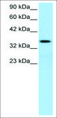 Anti-LEF1 (AB1) antibody produced in rabbit affinity isolated antibody