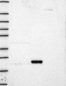 Anti-Kras Antibody Produced In Rabbit Prestige Antibodies® Powered by Atlas Antibodies, affinity isolated antibody, buffered aqueous glycerol solution