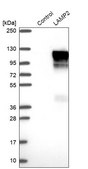 Anti-LAMP2 antibody produced in rabbit Prestige Antibodies® Powered by Atlas Antibodies, affinity isolated antibody, buffered aqueous glycerol solution