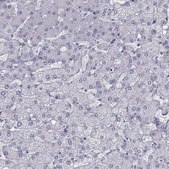 Anti-QPCT antibody produced in rabbit Prestige Antibodies® Powered by Atlas Antibodies, affinity isolated antibody, buffered aqueous glycerol solution