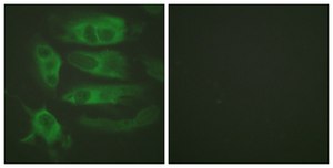 Anti-Adrenergic Receptor β2 antibody produced in rabbit affinity isolated antibody