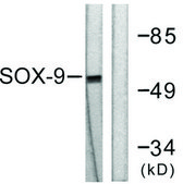 Anti-SOX9 antibody produced in rabbit affinity isolated antibody