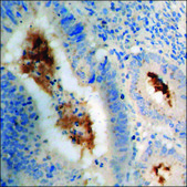 Anti-phospho-VEGFR2 (pTyr1175) antibody produced in rabbit affinity isolated antibody