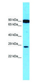 Anti-HGF (ab2) antibody produced in rabbit affinity isolated antibody