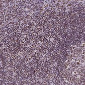 Monoclonal Anti-REST antibody produced in mouse Prestige Antibodies® Powered by Atlas Antibodies, clone CL0381, purified immunoglobulin, buffered aqueous glycerol solution