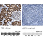 Anti-ASS1 antibody produced in rabbit Prestige Antibodies® Powered by Atlas Antibodies, affinity isolated antibody, buffered aqueous glycerol solution