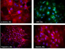 AC16 Human Cardiomyocyte Cell Line AC16 Human Cardiomyocytes can be serially passaged and can differentiate when cultured in mitogen-free medium. The cells may be used to study developmental regulation of cardiomyocytes.